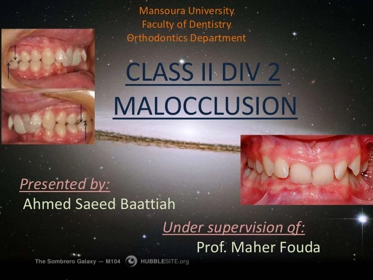 Malocclusion overjet